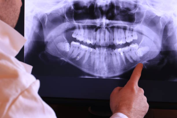 Best Urgent Tooth Repair  in Bean Station, TN